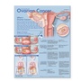 Cover: Understanding Ovarian Cancer Anatomical Chart - Lippincott Williams and Wilkins