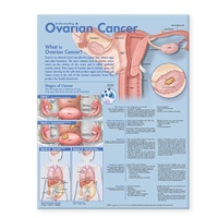 Enlarge image Cover: Understanding Ovarian Cancer Anatomical Chart - Lippincott Williams and Wilkins