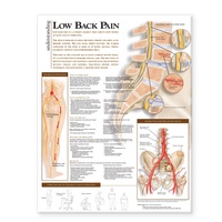 Abbildung von: Understanding Low Back Pain Anatomical Chart - Lippincott Williams and Wilkins