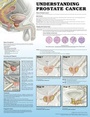 Cover: Understanding Prostate Cancer 2e Laminated - Lippincott Williams and Wilkins