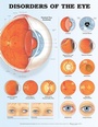 Cover: Disorders of the Eye Anatomical Chart - Anatomical Chart Co.
