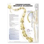 Cover: Understanding Multiple Sclerosis Anatomical Chart - Anatomical Chart Co.