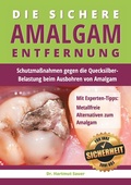 Cover: Die sichere Amalgam-Entfernung - BoD - Books on Demand