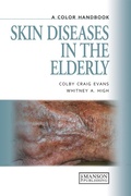 Cover: Skin Diseases in the Elderly - CRC Press