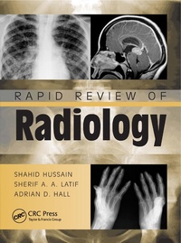Enlarge image Cover: Rapid Review of Radiology - CRC Press