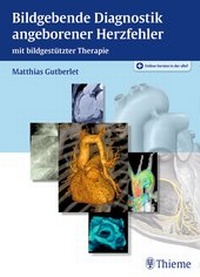 Abbildung von: Bildgebende Diagnostik angeborener Herzfehler - Thieme