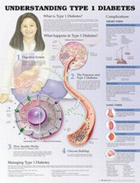 Abbildung von: Understanding Type 1 Diabetes Anatomical Chart - Lippincott Williams and Wilkins
