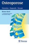 Cover: Osteoporose - Thieme