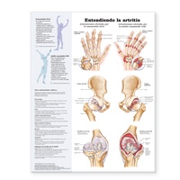 Abbildung von: Understanding Arthritis Spanish - Lippincott Williams and Wilkins