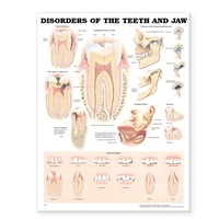 Abbildung von: Disorders of the Teeth and Jaw Anatomical Chart - Anatomical Chart Co.