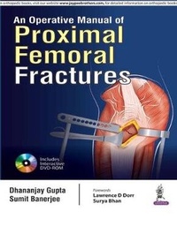 Enlarge image Cover: An Operative Manual of Proximal Femoral Fractures - Jaypee Brothers Medical Publishers