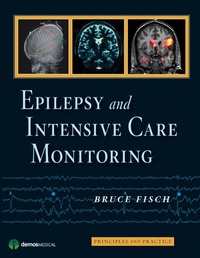 Bild: Epilepsy and Intensive Care Monitoring - Texas Tech University Press