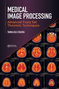 Abbildung von: Medical Image Processing - CRC Press