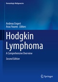Cover: Hodgkin Lymphoma - Springer