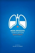 Cover: Non-Invasive Ventilation Made Simple 2nd Edition - 5M Books Ltd