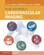 Cover: Pearls and Pitfalls in Cardiovascular Imaging - Cambridge University Press