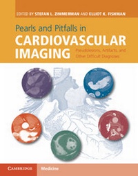 Enlarge image Cover: Pearls and Pitfalls in Cardiovascular Imaging - Cambridge University Press
