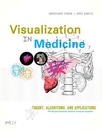 Enlarge image Cover: Visual Computing for Medicine - Morgan Kaufmann