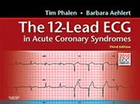Abbildung von: The 12-Lead ECG in Acute Coronary Syndromes