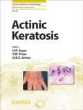 Cover: Actinic Keratosis - S. Karger