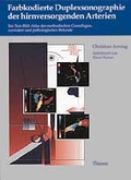 Cover: Farbkodierte Duplexsonographie der hirnversorgenden Arterien - Thieme