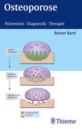 Cover: Osteoporose - Thieme