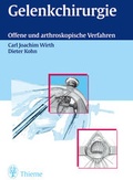 Cover: Gelenkchirurgie - Thieme
