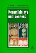 Cover: Keramikinlays und Veneers - Hanser