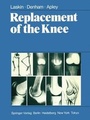 Cover: Replacement of the Knee - Springer