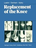 Abbildung von: Replacement of the Knee - Springer