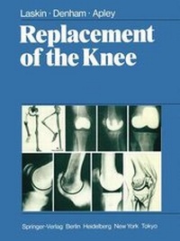 Abbildung von: Replacement of the Knee - Springer