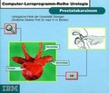 Cover: Prostatakarzinom - Springer