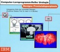 Cover: Benigne Prostatahyperplasie - Springer