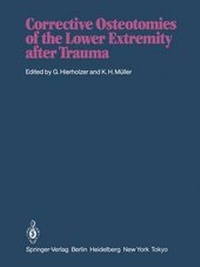 Abbildung von: Corrective Osteotomies of the Lower Extremity after Trauma - Springer