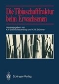 Cover: Die Tibiaschaftfraktur beim Erwachsenen - Springer