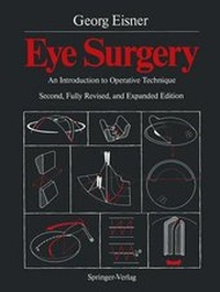 Enlarge image Cover: Eye Surgery - Springer