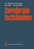 Abbildung von: Zerebrale Ischämien - Springer