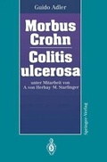 Cover: Morbus Crohn Colitis ulcerosa - Springer