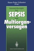 Abbildung von: Intensivtherapie bei Sepsis und Multiorganversagen - Springer