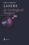 Cover: Lasers in Urological Surgery - Springer