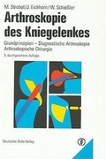 Cover: Arthroskopie des Kniegelenkes - Deutscher &Auml;rzteverlag