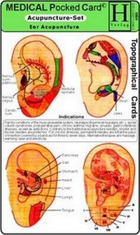 Abbildung von: Acupuncture Set /Medical Pocket Card Set - Hawelka, Uwe