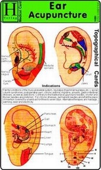 Abbildung von: Ear Acupuncture - Medical Card - Hawelka, Uwe