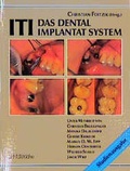 Cover: ITI - Das Dental-Implantat-System - Schl&uuml;tersche