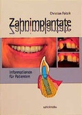 Cover: Zahnimplantate - Schl&uuml;tersche