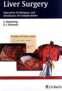 Enlarge image Cover: Liver Surgery - MVS Medizinverlage Stuttgart