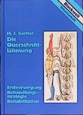Cover: Die Querschnittl&auml;hmung - Blackwell Bln