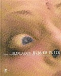 Cover: Blaue Augen, blauer Fleck - Parthas