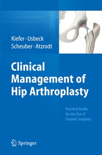 Abbildung von: Clinical Management of Hip Arthroplasty - Springer