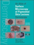 Cover: An Atlas of Surface Microscopy of Pigmented Skin Lesions: Dermoscopy, Second Edition - McGraw-Hill Medical
